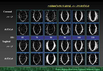 medicina 2014年 増刊号 CT・MRI “戦略的